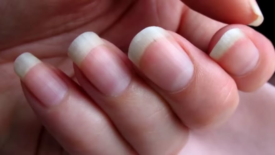 nail