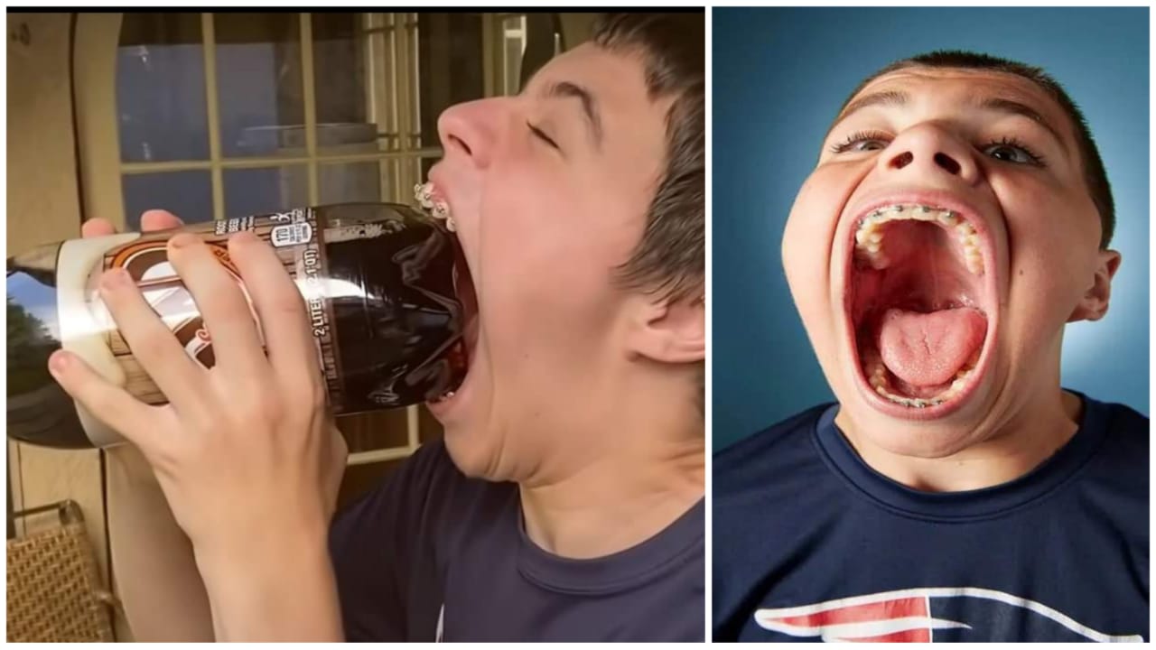large-mouth